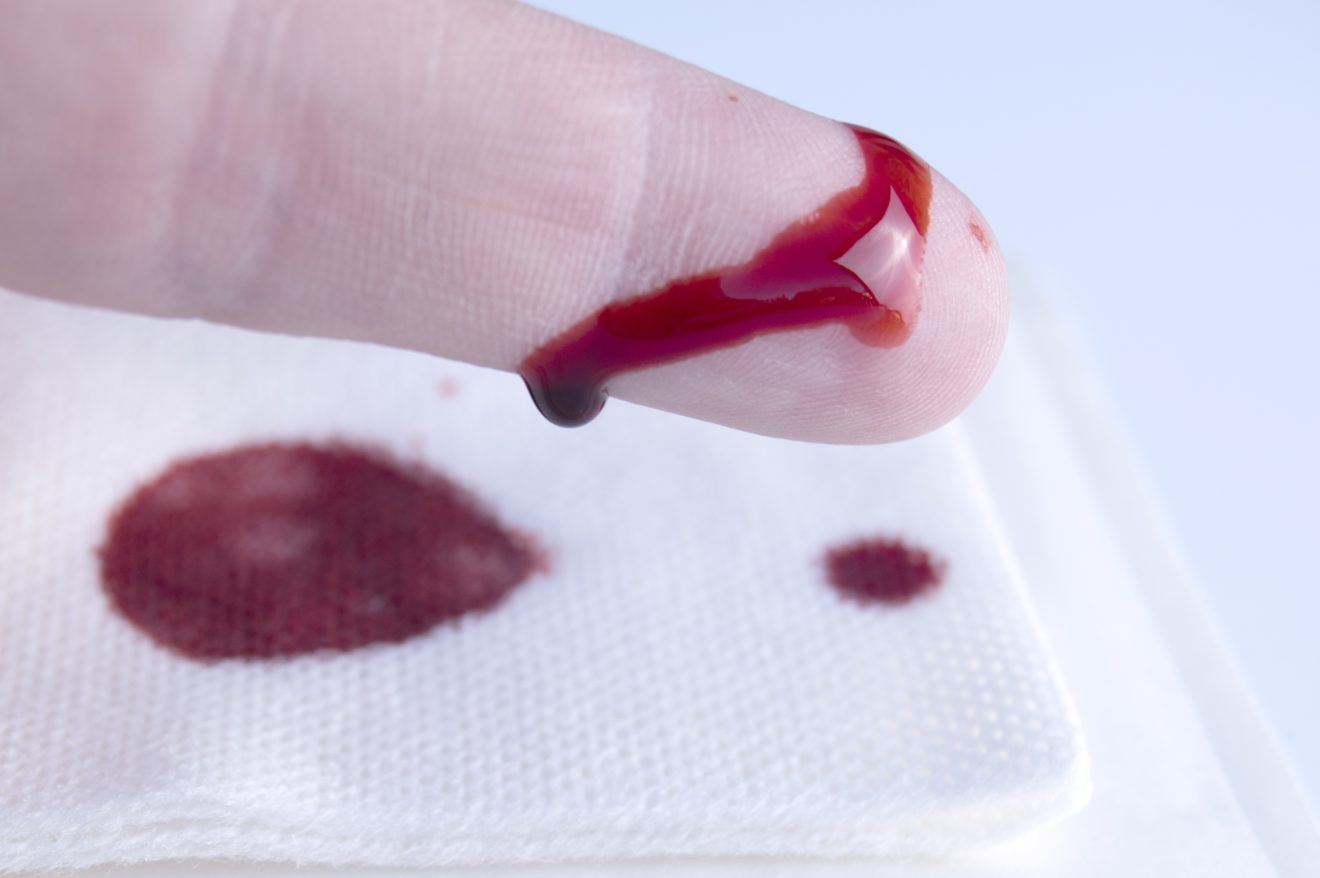 Scalpel Cuts in the Manufacturing Industry Qlicksmart Sharps Safety